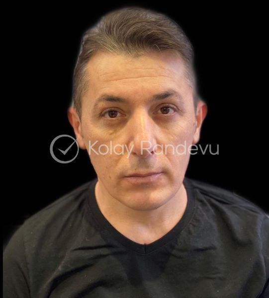 COŞKUN